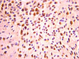 Immunohistochemistry (Formalin/PFA-fixed paraffin-embedded sections) - Anti-Olig2 antibody - Oligodendrocyte Marker (AB136253)