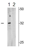 Western blot - Anti-Olig2 (phospho S10 + S13 + S14) antibody (AB183487)