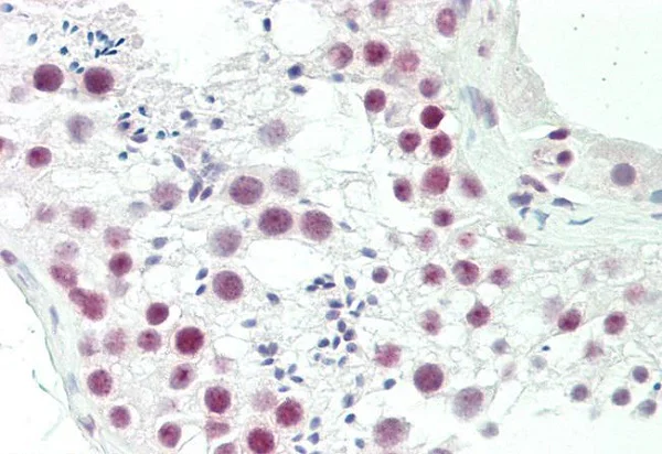 Immunohistochemistry (Formalin/PFA-fixed paraffin-embedded sections) - Anti-Olig3 antibody (AB230626)
