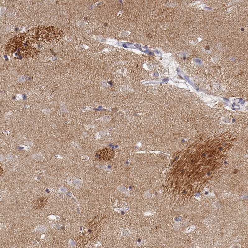 Immunohistochemistry (Formalin/PFA-fixed paraffin-embedded sections) - Anti-Oligodendrocyte myelin glycoprotein antibody (AB224254)