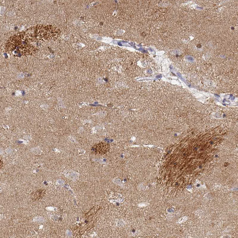 Immunohistochemistry (Formalin/PFA-fixed paraffin-embedded sections) - Anti-Oligodendrocyte myelin glycoprotein antibody (AB224254)