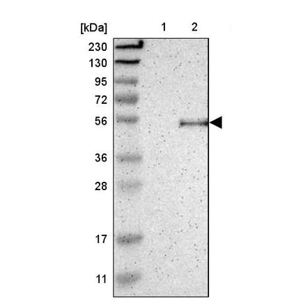 Western blot - Anti-Oligodendrocyte myelin glycoprotein antibody (AB224254)