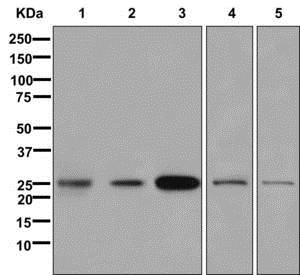 Western blot - Anti-Oligodendrocyte Specific Protein antibody [EPR12726] - Oligodendrocyte Marker (AB175236), expandable thumbnail
