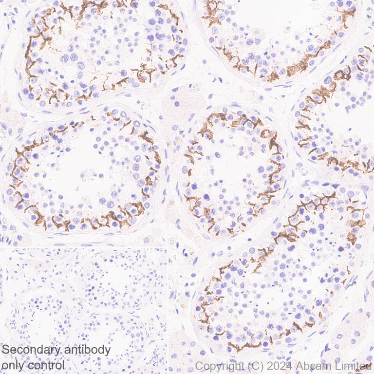 Immunohistochemistry (Formalin/PFA-fixed paraffin-embedded sections) - Anti-Oligodendrocyte Specific Protein antibody [EPR29593-15] (AB323317)