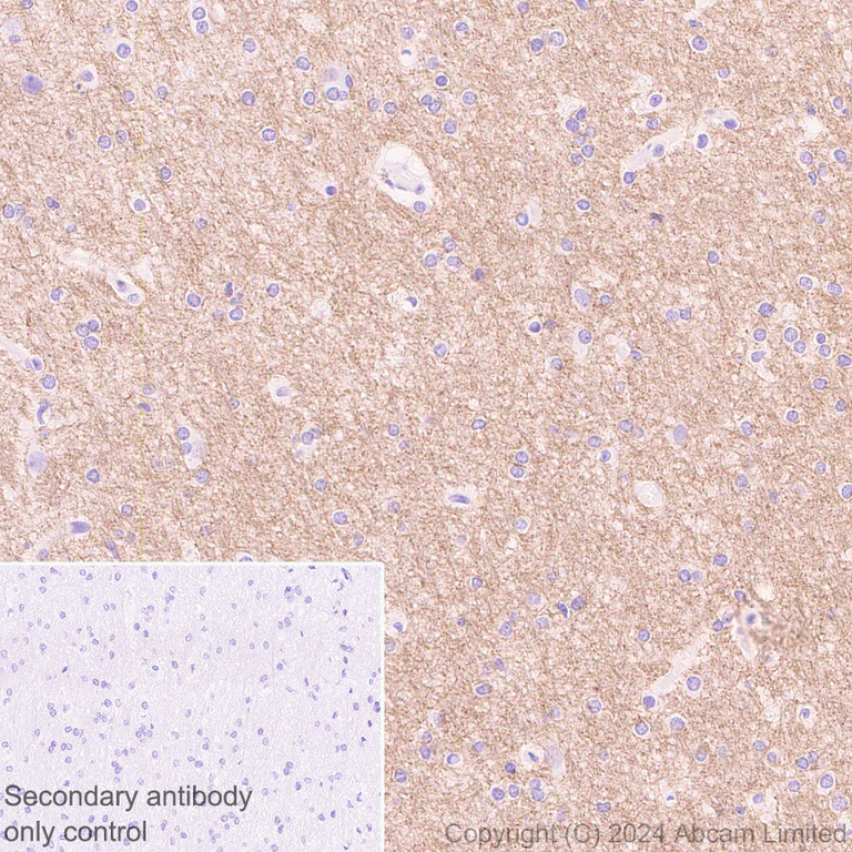 Immunohistochemistry (Formalin/PFA-fixed paraffin-embedded sections) - Anti-Oligodendrocyte Specific Protein antibody [EPR29593-15] (AB323317)