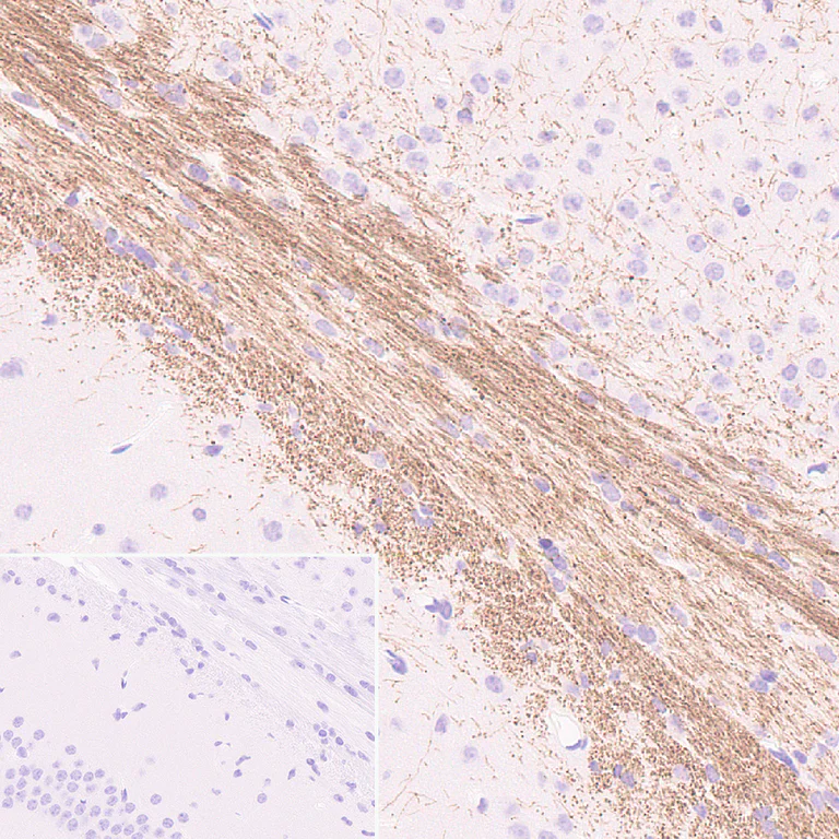 Immunohistochemistry (Formalin/PFA-fixed paraffin-embedded sections) - Anti-Oligodendrocyte Specific Protein antibody [EPR29593-15] (AB323317)