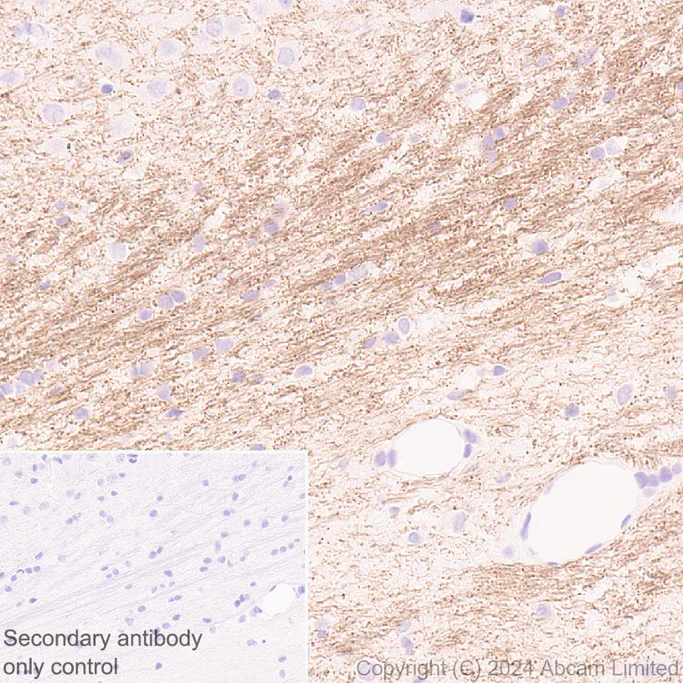 Immunohistochemistry (Formalin/PFA-fixed paraffin-embedded sections) - Anti-Oligodendrocyte Specific Protein antibody [EPR29593-15] (AB323317)