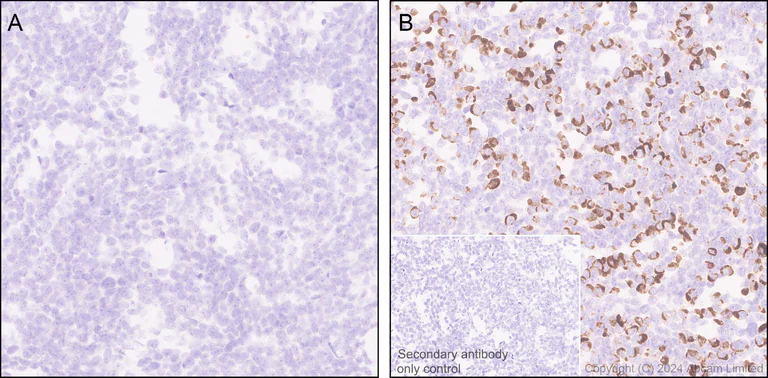 Immunohistochemistry (Formalin/PFA-fixed paraffin-embedded sections) - Anti-Oligodendrocyte Specific Protein antibody [EPR29593-15] (AB323317)