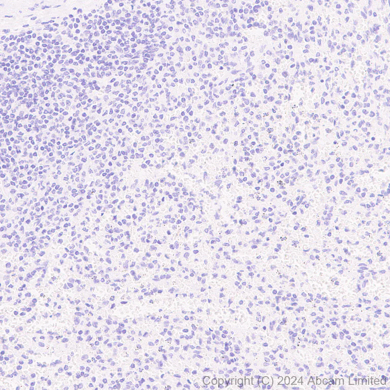 Immunohistochemistry (Formalin/PFA-fixed paraffin-embedded sections) - Anti-Oligodendrocyte Specific Protein antibody [EPR29593-15] (AB323317)