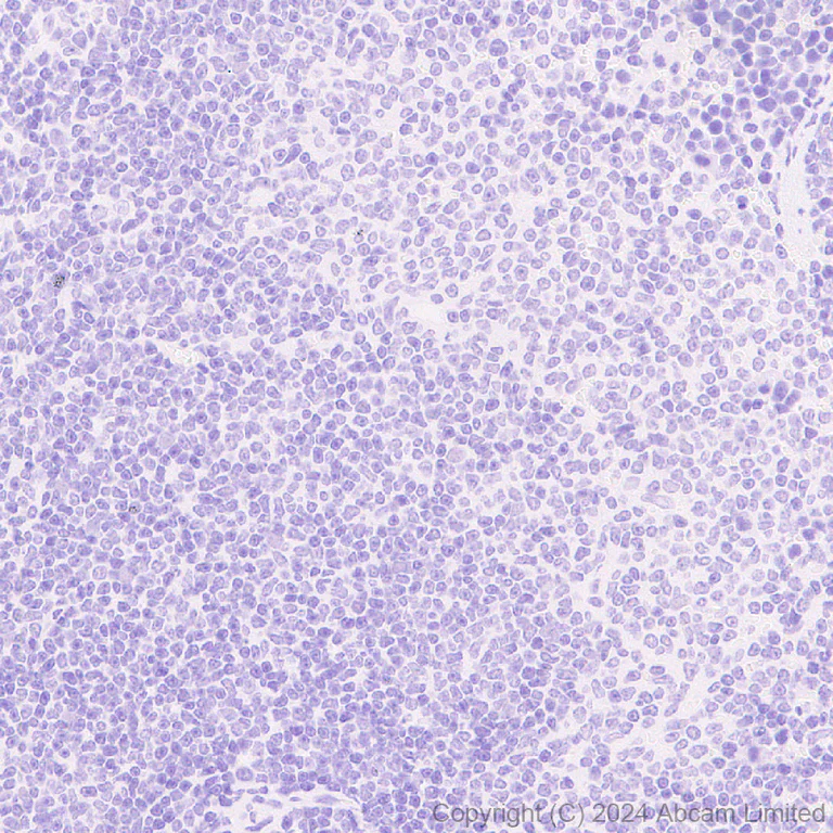 Immunohistochemistry (Formalin/PFA-fixed paraffin-embedded sections) - Anti-Oligodendrocyte Specific Protein antibody [EPR29593-15] (AB323317)
