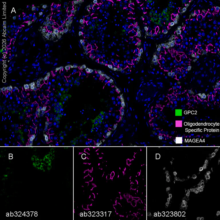 Multiplex immunohistochemistry - Anti-Oligodendrocyte Specific Protein antibody [EPR29593-15] (AB323317)
