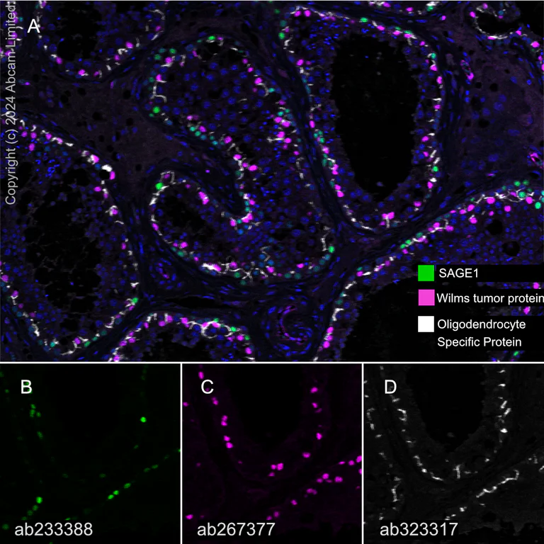 Multiplex immunohistochemistry - Anti-Oligodendrocyte Specific Protein antibody [EPR29593-15] (AB323317)