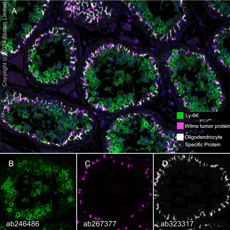 Multiplex immunohistochemistry - Anti-Oligodendrocyte Specific Protein antibody [EPR29593-15] (AB323317)