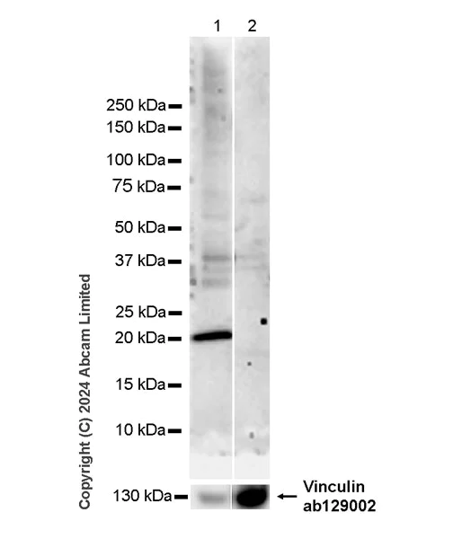 Western blot - Anti-Oligodendrocyte Specific Protein antibody [EPR29593-15] (AB323317)