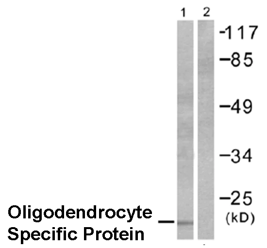 Western blot - Anti-Oligodendrocyte Specific Protein antibody - Oligodendrocyte Marker (AB53041)