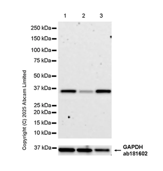 Western blot - Anti-OMA1 antibody [EPR29198-78] (AB324586)