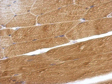 Immunohistochemistry (Formalin/PFA-fixed paraffin-embedded sections) - Anti-OMD antibody (AB154249)