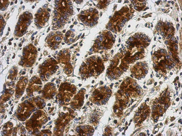 Immunohistochemistry (Formalin/PFA-fixed paraffin-embedded sections) - Anti-OMD antibody (AB154249)