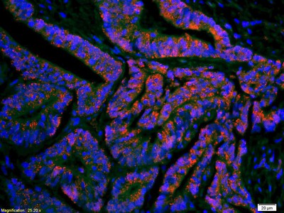 Immunohistochemistry (Formalin/PFA-fixed paraffin-embedded sections) - Anti-ompF antibody (AB203223), expandable thumbnail