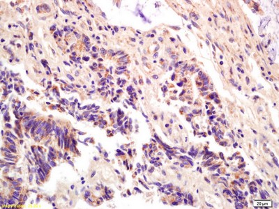 Immunohistochemistry (Formalin/PFA-fixed paraffin-embedded sections) - Anti-ompF antibody (AB203223), expandable thumbnail