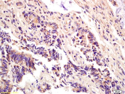 Immunohistochemistry (Formalin/PFA-fixed paraffin-embedded sections) - Anti-ompF antibody (AB203223)