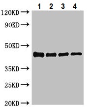 Western blot - Anti-ompK antibody (AB223118)