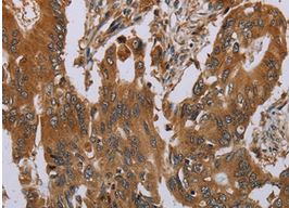 Immunohistochemistry (Formalin/PFA-fixed paraffin-embedded sections) - Anti-Oncostatin M/OSM antibody (AB198830)