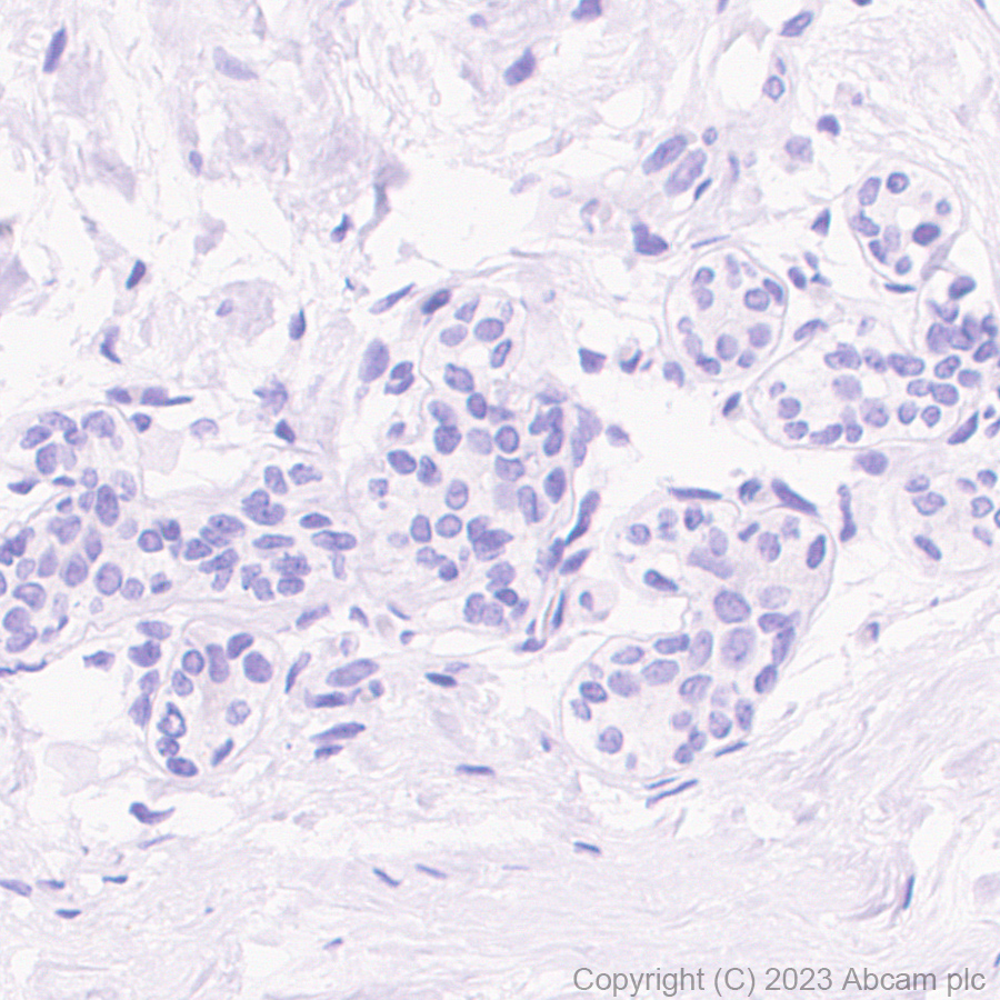 Immunohistochemistry (Formalin/PFA-fixed paraffin-embedded sections) - Anti-Oncostatin M/OSM antibody [EPR26065-14] (AB307951)