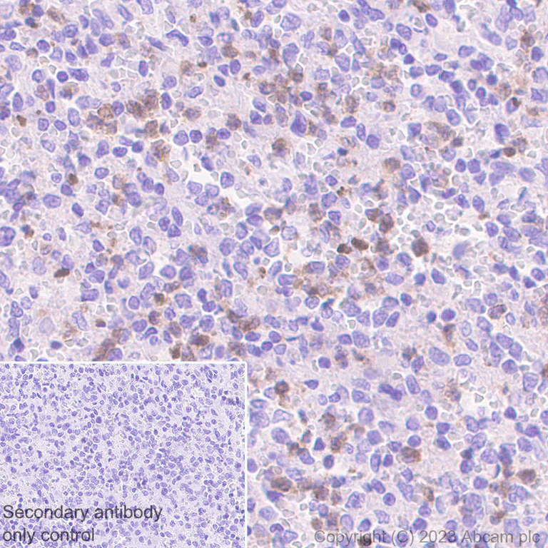 Immunohistochemistry (Formalin/PFA-fixed paraffin-embedded sections) - Anti-Oncostatin M/OSM antibody [EPR26065-14] - BSA and Azide free (AB307952)