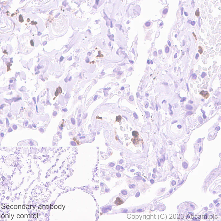 Immunohistochemistry (Formalin/PFA-fixed paraffin-embedded sections) - Anti-Oncostatin M/OSM antibody [EPR26065-14] - BSA and Azide free (AB307952)