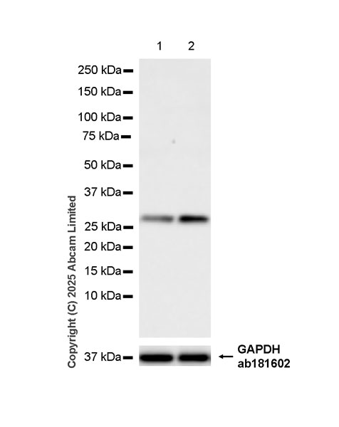 Western blot - Anti-Oncostatin M/OSM antibody [EPR26066-16] (AB323383), expandable thumbnail