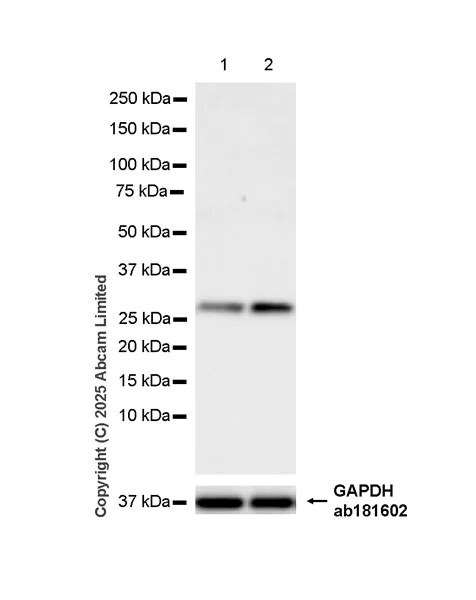 Western blot - Anti-Oncostatin M/OSM antibody [EPR26066-16] (AB323383)