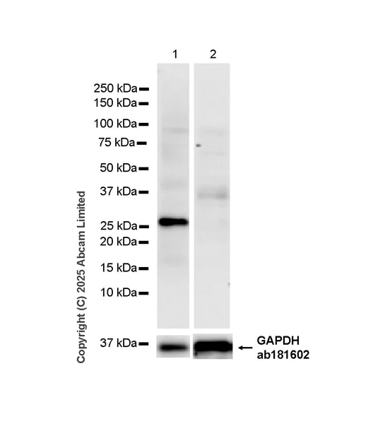Western blot - Anti-Oncostatin M/OSM antibody [EPR26066-16] (AB323383)