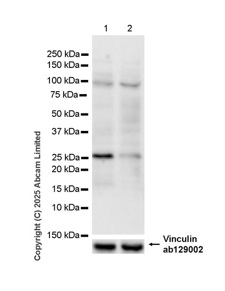Western blot - Anti-Oncostatin M/OSM antibody [EPR26066-16] (AB323383), expandable thumbnail