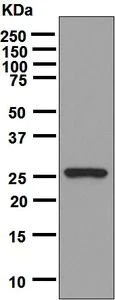 Western blot - Anti-Oncostatin M/OSM antibody [EPR7150] - BSA and Azide free (AB206992)