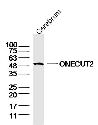 Western blot - Anti-ONECUT2/Oc2 Antibody (AB317370)