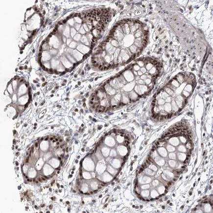 Immunohistochemistry (Formalin/PFA-fixed paraffin-embedded sections) - Anti-OPA1L antibody (AB243825)