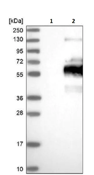 Western blot - Anti-OPA1L antibody (AB243825)