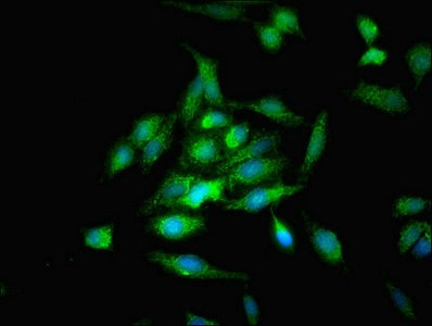 Immunocytochemistry/ Immunofluorescence - Anti-OPA3 antibody (AB230205)