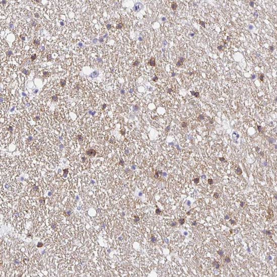 Immunohistochemistry (Formalin/PFA-fixed paraffin-embedded sections) - Anti-OPALIN antibody (AB121425)