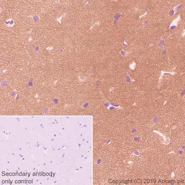 Immunohistochemistry (Formalin/PFA-fixed paraffin-embedded sections) - Anti-OPCML antibody [EPR22947-46] (AB238143)