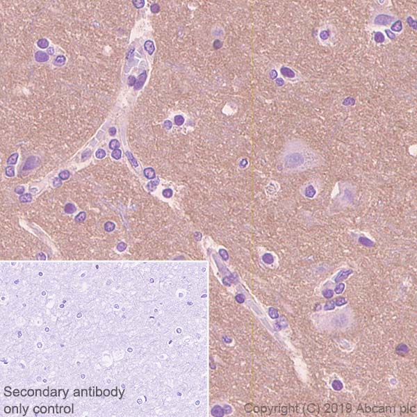 Immunohistochemistry (Formalin/PFA-fixed paraffin-embedded sections) - Anti-OPCML antibody [EPR22947-46] (AB238143)
