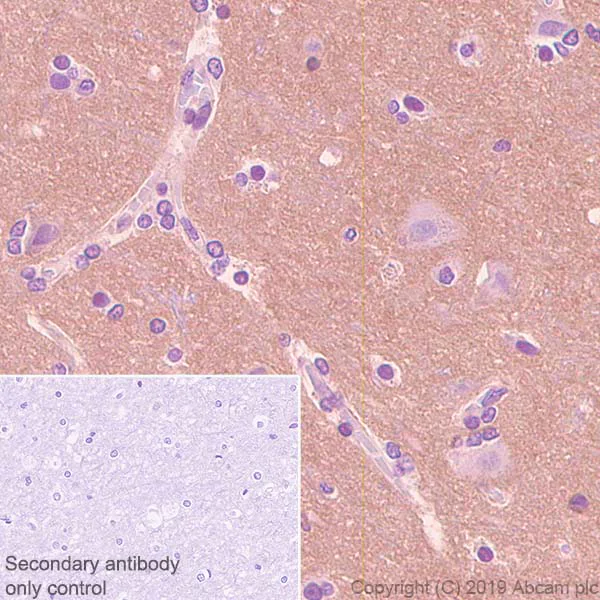 Immunohistochemistry (Formalin/PFA-fixed paraffin-embedded sections) - Anti-OPCML antibody [EPR22947-46] (AB238143)