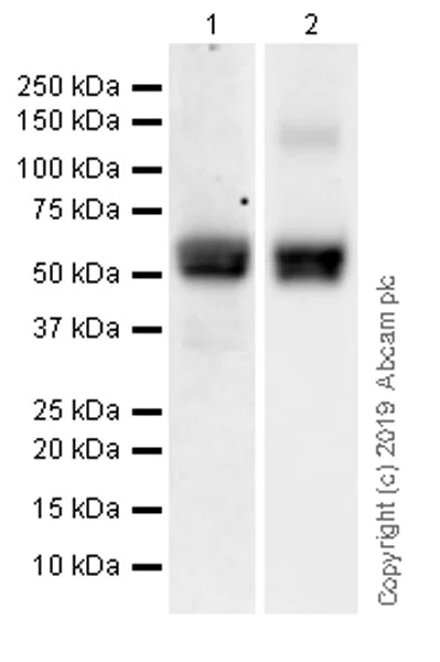 Western blot - Anti-OPCML antibody [EPR22947-46] (AB238143)