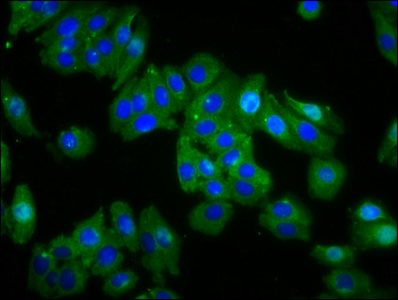 Immunocytochemistry/ Immunofluorescence - Anti-Opn1mw antibody (AB236916), expandable thumbnail