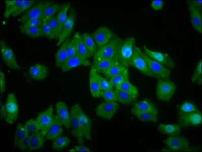 Immunocytochemistry/ Immunofluorescence - Anti-Opn1mw antibody (AB236916)