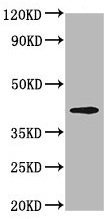 Western blot - Anti-Opn1mw antibody (AB236916), expandable thumbnail