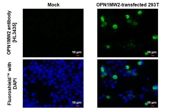 Immunocytochemistry/ Immunofluorescence - Anti-OPN1MW antibody [HL3435] - BSA and Azide free (AB325868)