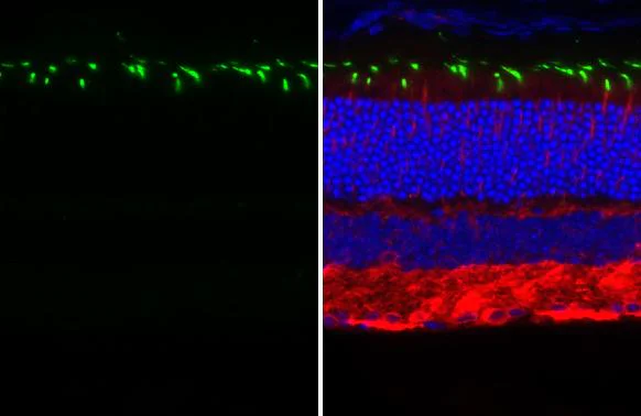 Immunohistochemistry (Formalin/PFA-fixed paraffin-embedded sections) - Anti-OPN1MW antibody [HL3435] - BSA and Azide free (AB325868)