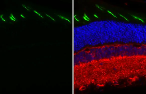 Immunohistochemistry (Formalin/PFA-fixed paraffin-embedded sections) - Anti-OPN1MW antibody [HL3435] - BSA and Azide free (AB325868)
